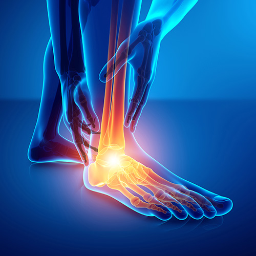 Ankle