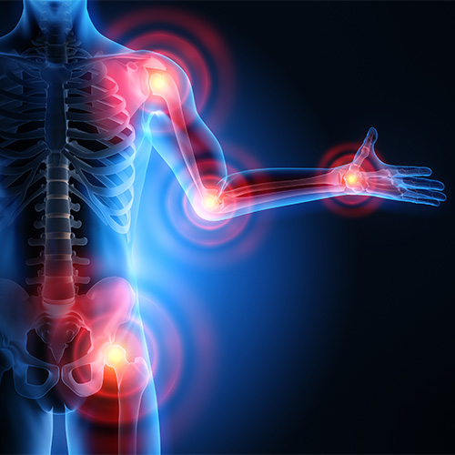 Fractures & Trauma